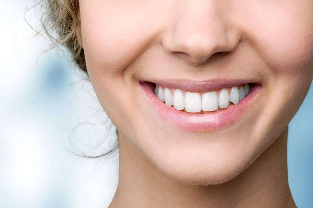 ¿De qué trata la cirugía de sonrisa gingival?