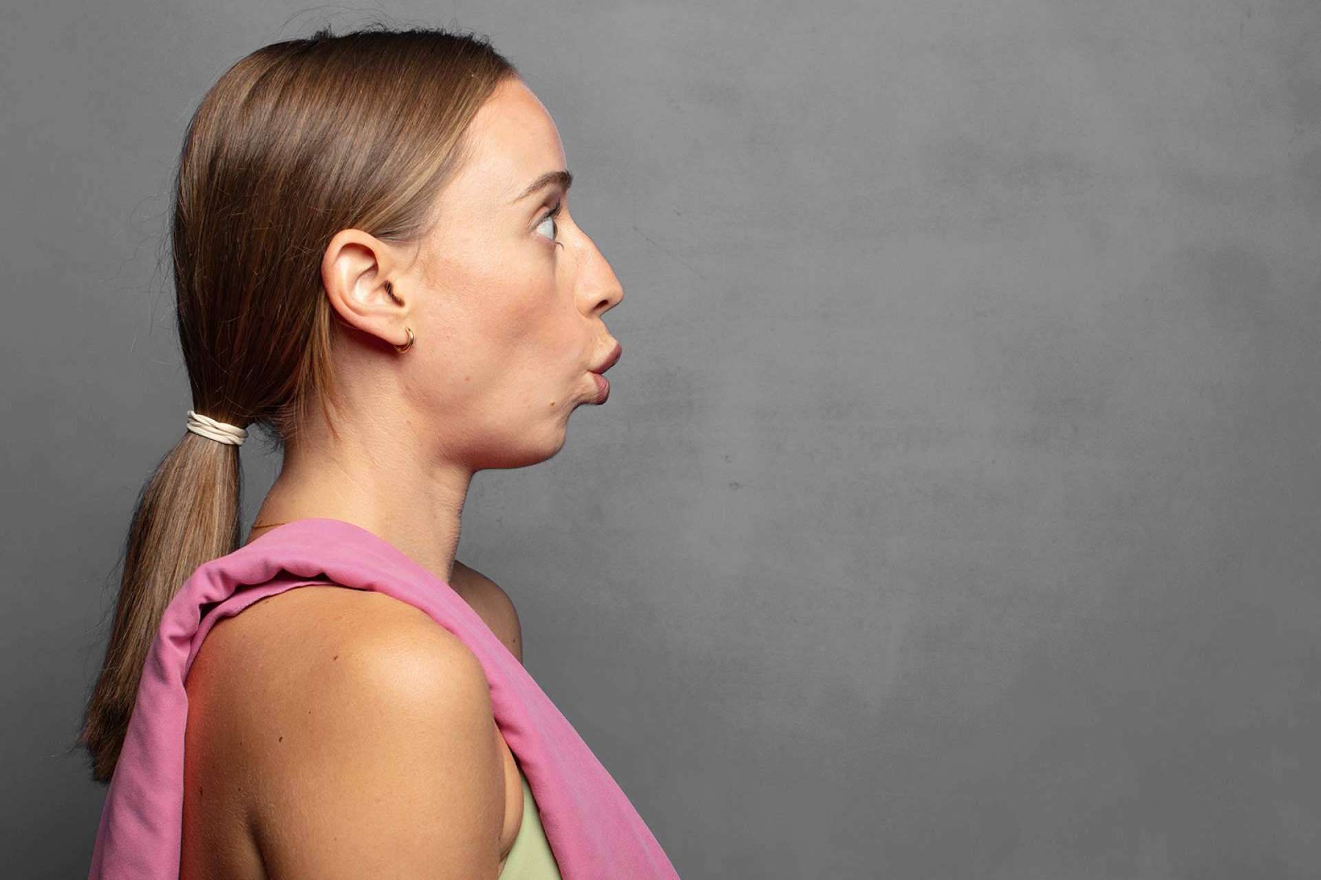 El secreto para un rostro más firme; Tratamientos efectivos para la papada
